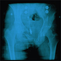 Mature Situations : Cracked Pelvis (7", Cle)